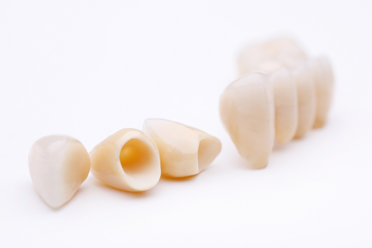 oral implants