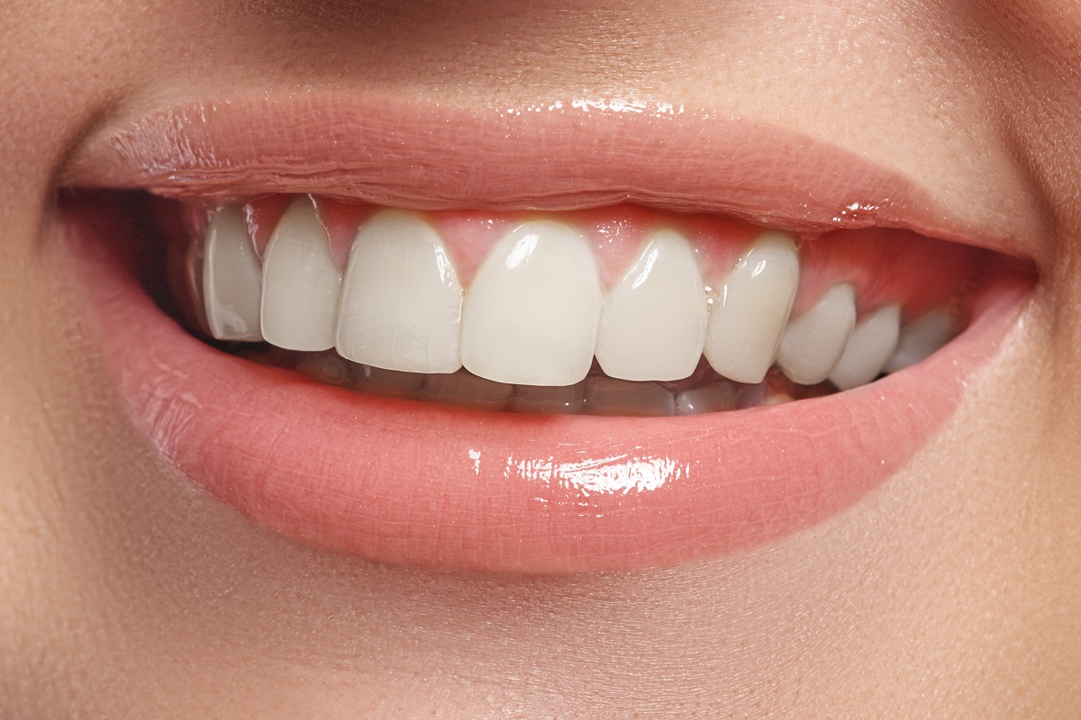 close up of a smile with white teeth